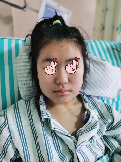 静脉窦--孩子正脸照.jpg